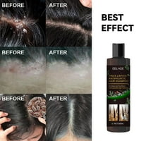 Kehuo Anti-Itch šampon za Tinea Capitis za uklanjanje peruti i ublažiti svrbež vlasište, ljepotu i ličnu