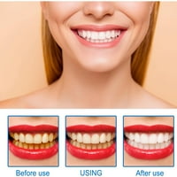 GZWCCVSN izbjeljivanje zuba Restorativna oralna čišćenja osvjetljavanja restauracije emajle Svježe dah mrlje, 10ml