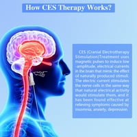 CES kranijalni električni terapijski uređaj za ublažavanje nesanice, stresa i anksioznosti