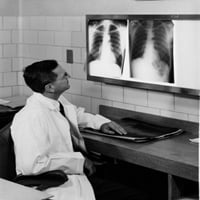 Doktor analiza rendgenskih rendgenskih slika pluća